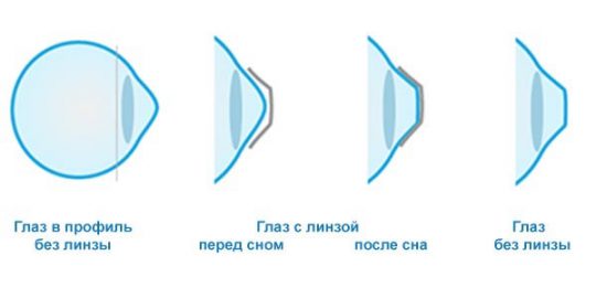 С помощью какой линзы можно получить увеличенное изображение